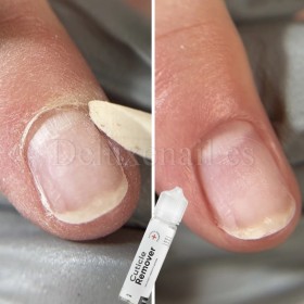 copy of Komilfo Cuticle Remover - Removedor para cutícula, 8 ml.