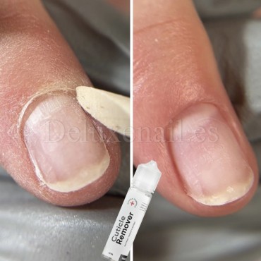 copy of Komilfo Cuticle Remover - Removedor para cutícula, 8 ml.
